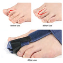AlignStep™ Toe Support Corrector