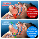 Anti Snore MouthPiece